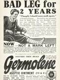 1935 Germolene bad leg- vintage ad